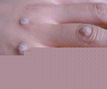 上環診斷方法和檢查項目