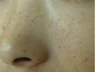 月經疾病的形成的因素有哪些